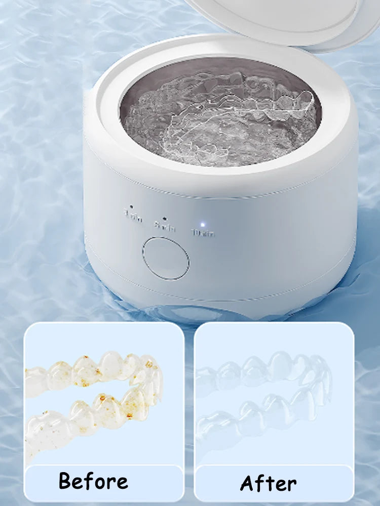 FreshGuard Sonic – Portable Ultrasonic Retainer Cleaner